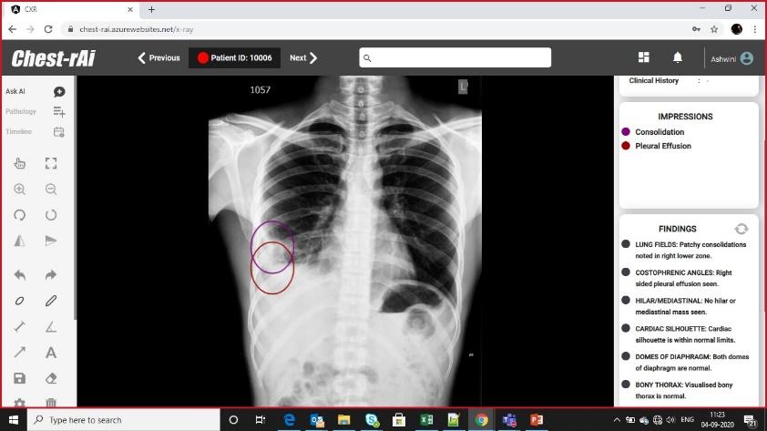 AI in Radiology video thumbnail