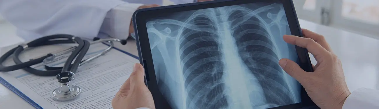 Chest rAI: AI based Radiologist Assist Solution