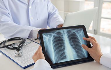 Chest-rAI: AI based Radiologist Assist Solution